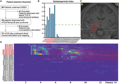 Direct Cortical Stimulation to Probe the Ictogenicity of the Epileptogenic Nodes in Temporal Lobe Epilepsy